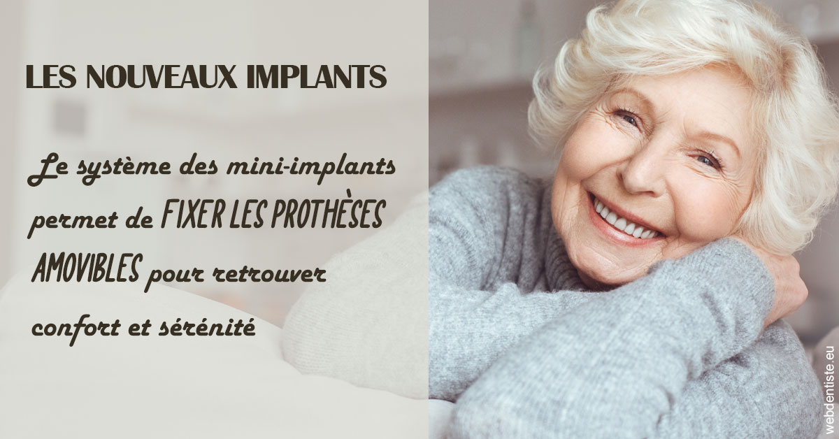 https://dr-cousin-julien.chirurgiens-dentistes.fr/Les nouveaux implants 1