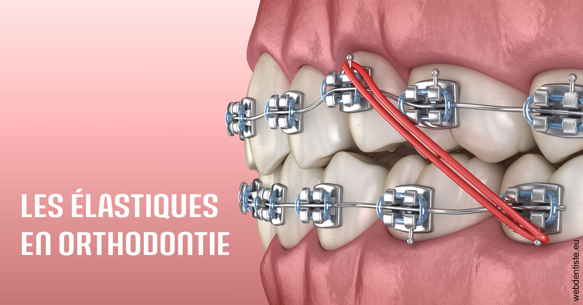 https://dr-cousin-julien.chirurgiens-dentistes.fr/Elastiques orthodontie 2