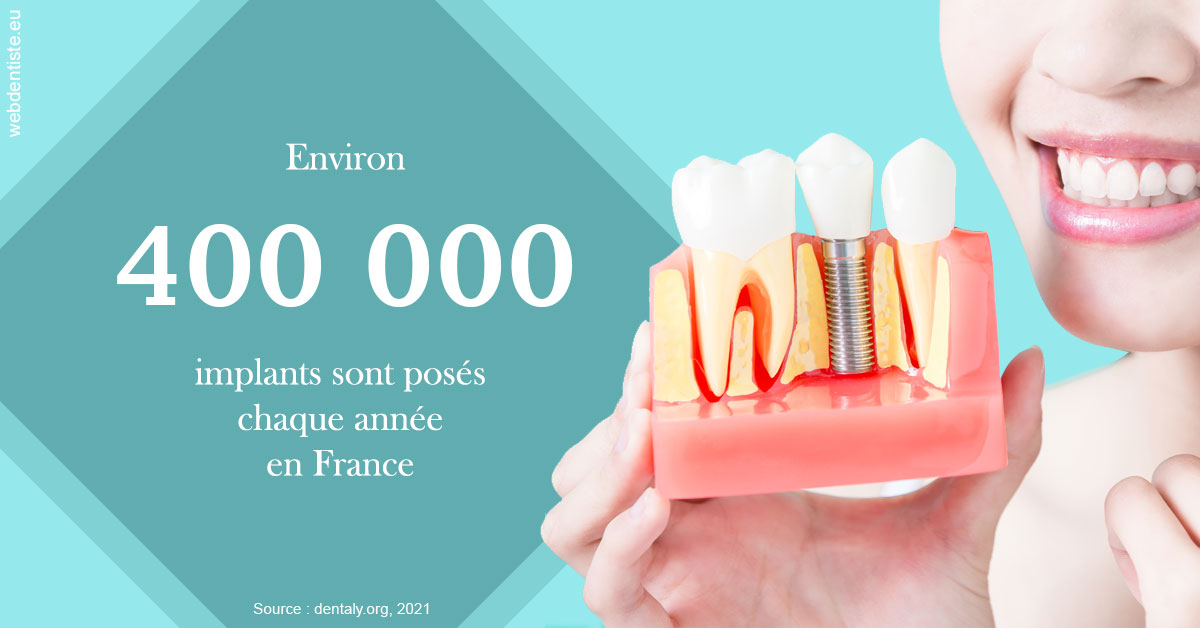 https://dr-cousin-julien.chirurgiens-dentistes.fr/Pose d'implants en France 2